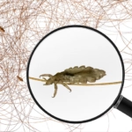 Lice Look Like