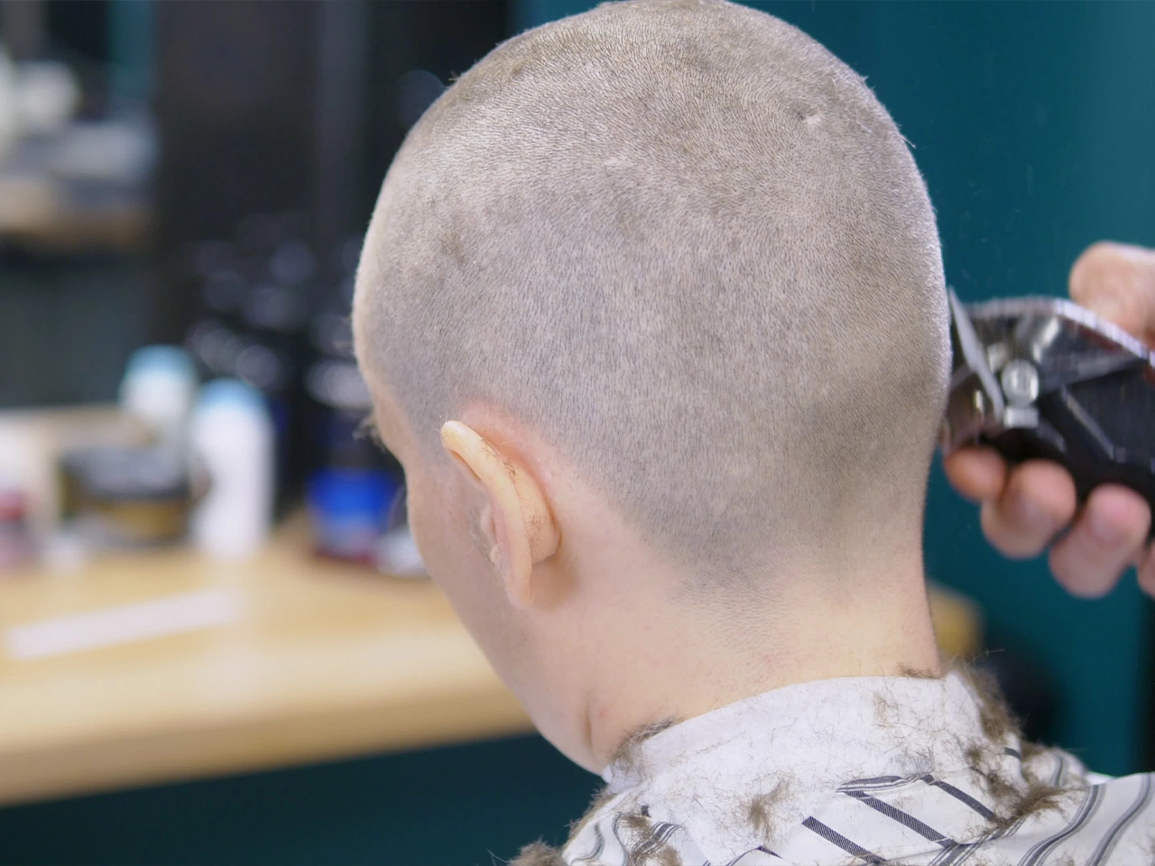 Battling the Buzz: Head Lice Outbreak in Coral Gables, Florida Keeps Kids Away from School